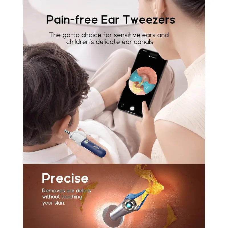 Bebird EarSight Plus I35R, showing its pain-free ear tweezers being used on a child with a smartphone showing an ear canal.