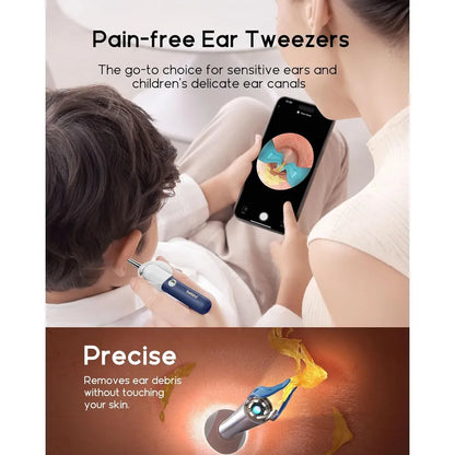 Bebird EarSight Plus I35R, showing its pain-free ear tweezers being used on a child with a smartphone showing an ear canal.