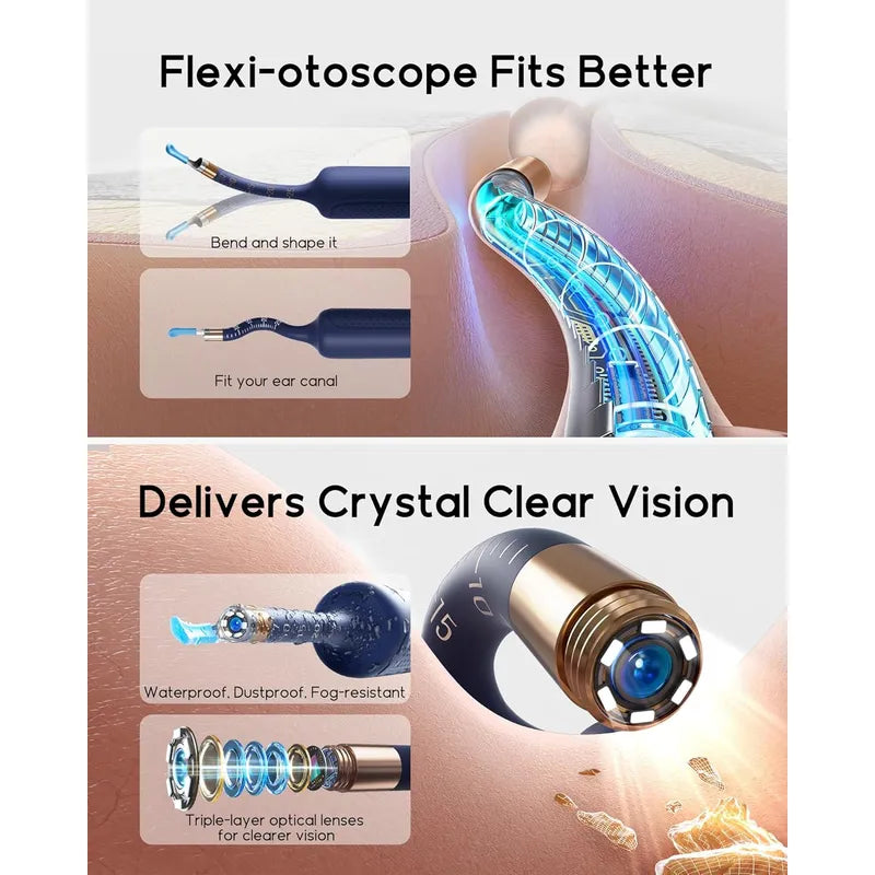 Bebird EarSight Plus I35R flexi-otoscope with features highlighted on a white background