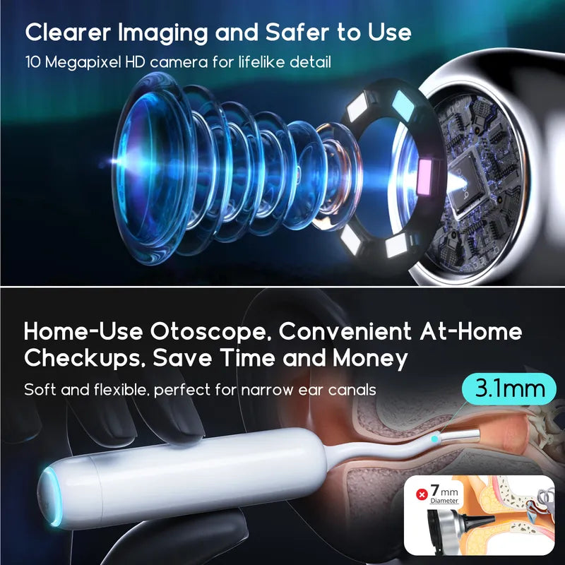 Bebird Home 30S home-use otoscope with lens and camera components, highlighting features like clear imaging and safety.