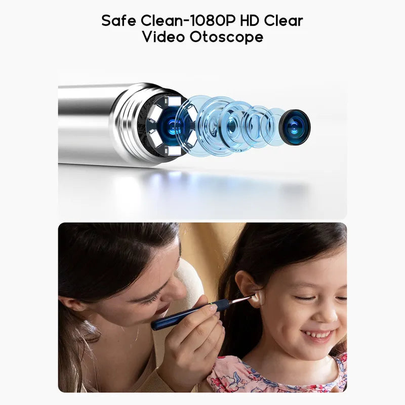 Bebird Note 5 Pro otoscope with 1080P HD clear video quality, used by a woman to check a child's ear.