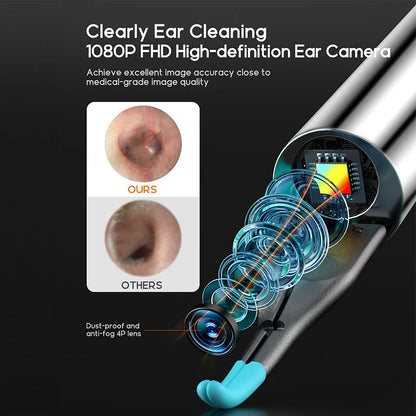 Bebird Note 5 Pro otoscope with detailed design and features on a black background