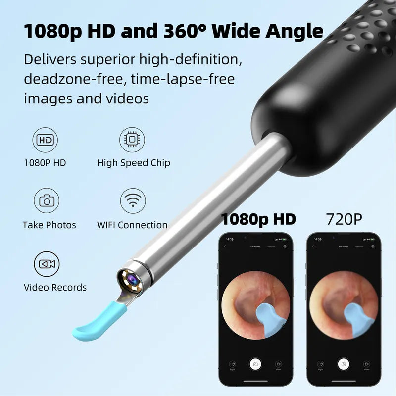 Bebird R1+ otoscope with 1080p HD and 360° wide angle features, showing images on smartphones.