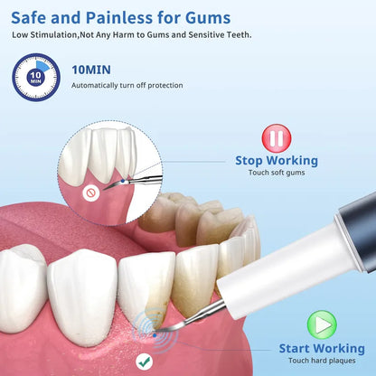Dental calculus cleaning tool with safety features for gums and teeth on a blue background