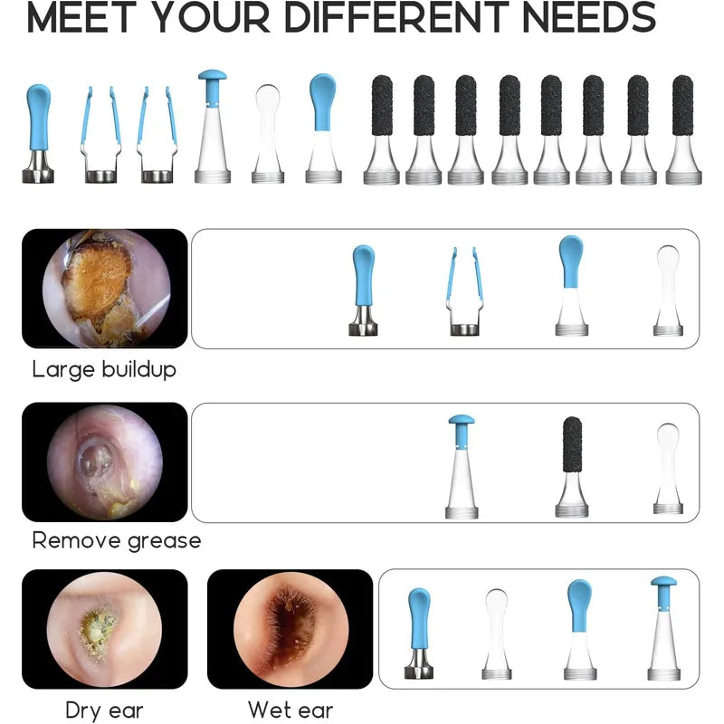 Bebird ear cleaning tips with different heads for various ear cleaning needs.