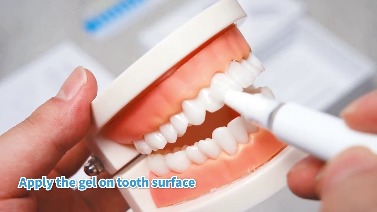 IVISMILE Teeth whitening kit demonstration video.